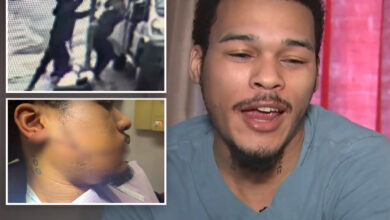 NYC Amazon worker needs 110 stitches after unprovoked slashing