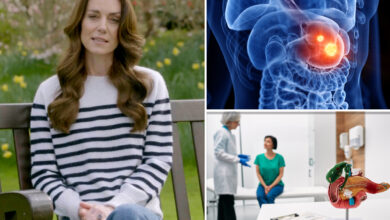 Kate Middleton's diagnosis comes amid early-onset cancer 'epidemic'