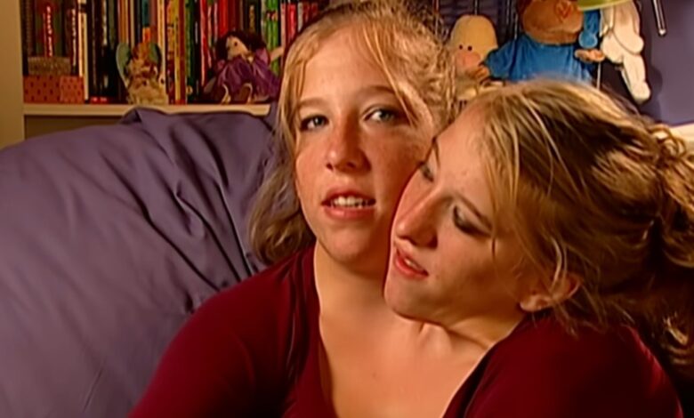 Conjoined Twin Abby Hensel’s Love Story With Josh Bowling