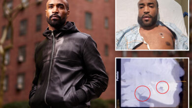 Model Adam Byrd left with broken jaw from brutal robbery outside swanky NYC lounge claims security just watched the attack