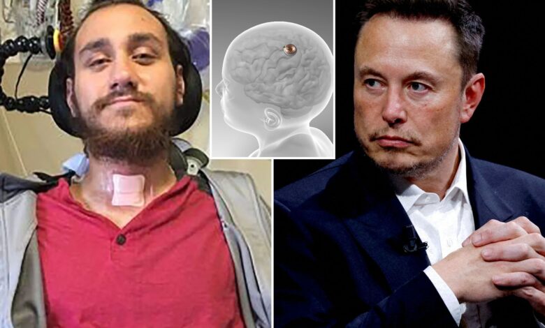 FDA OK's Elon Musk's Neuralink to implant brain chip into second patient