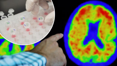 Accuracy of blood tests for Alzheimer’s disease varies: study