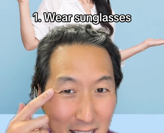 Wearing sunglasses, Youn said, can help prevent wrinkles that form around the outer corners of the eyes.