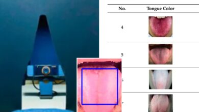 AI model 98% accurate in detecting diseases from a tongue pic