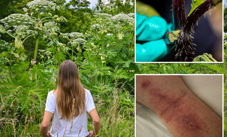 Giant Hogweed can cause third-degree burns -- and it's all over New York