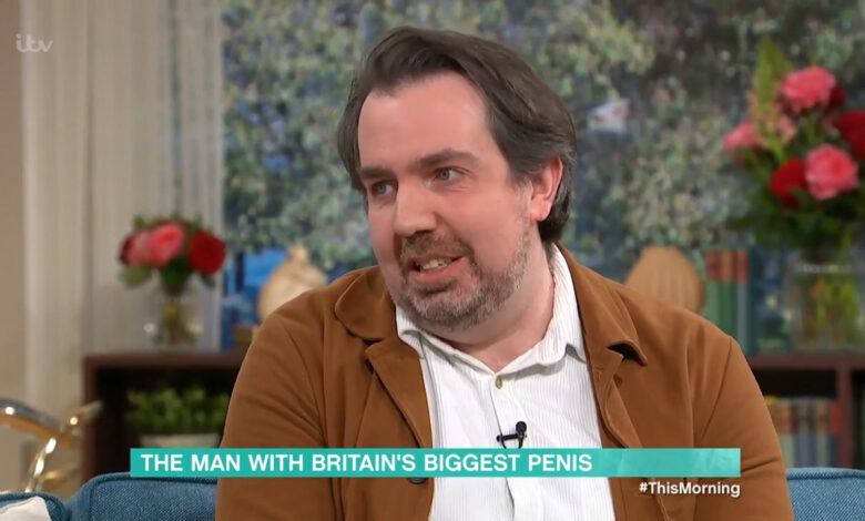 Man with 'world's largest penis' reveals the hardest things about his daily life