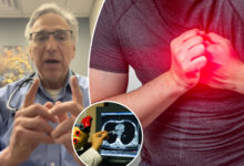 Cardiologist reveals 10 tips to avoid a heart attack by age 60