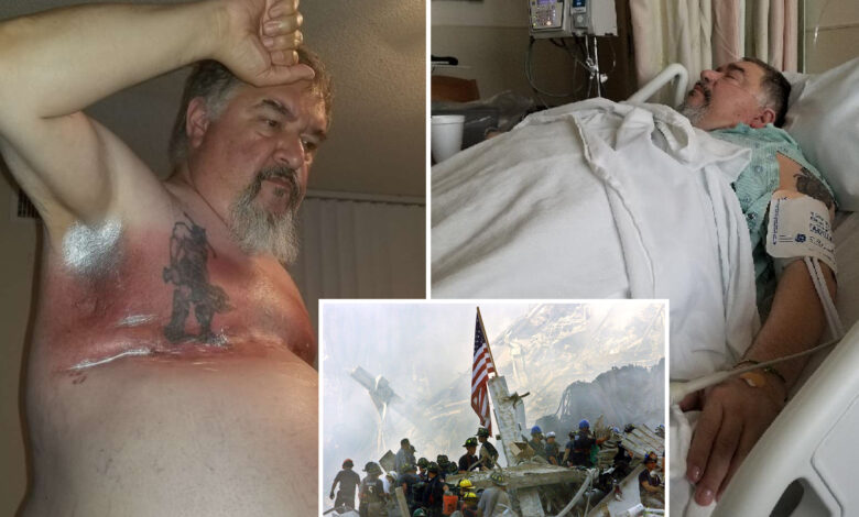 Exclusive | Number of men with breast cancer near NYC's Ground Zero skyrockets -