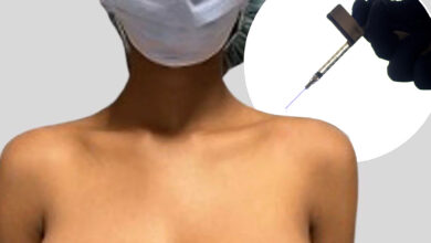 Teen's breasts grew to triple G-cup size following COVID vaccination: study