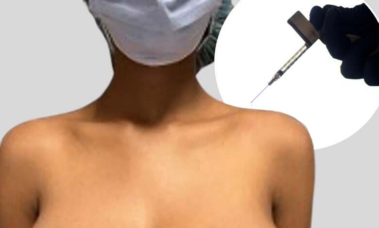 Teen's breasts grew to triple G-cup size following COVID vaccination: study