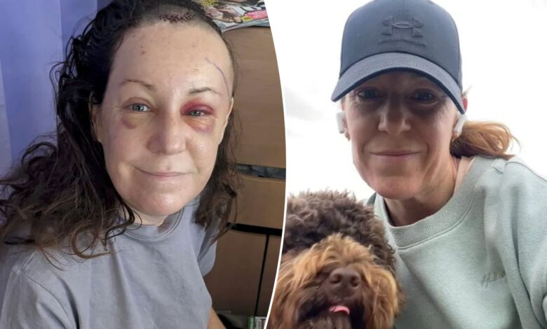 UK teacher Gemma Hillier diagnosed with brain tumor after failing eye exam