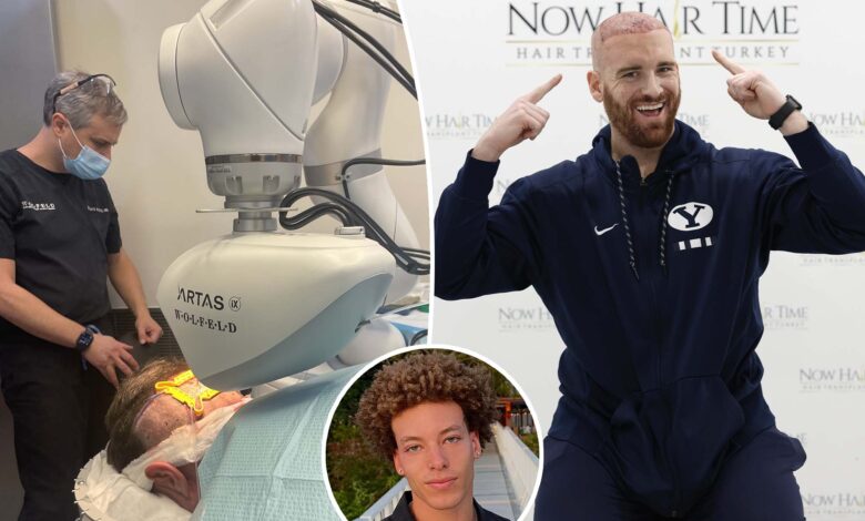 From Rogaine to robots: Trendiest hacks balding men using to get their hair back