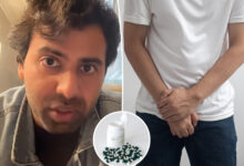 Common hair loss drug messed with man's erections and libido
