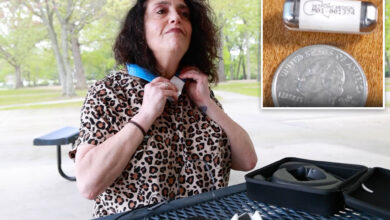 Here's how a bio implant stopped Long Island woman's 'horrific' arthritis in its tracks: 'This is the future'