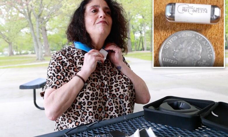 Here's how a bio implant stopped Long Island woman's 'horrific' arthritis in its tracks: 'This is the future'