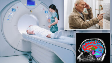 New tool gauges how fast your brain is aging, dementia risk