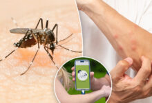 Stop itching fast with this new phone-powered bug bite zapper