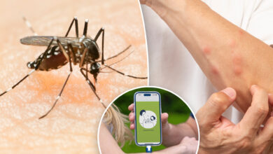 Stop itching fast with this new phone-powered bug bite zapper