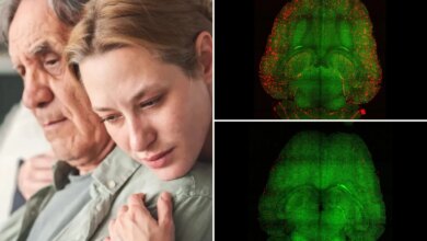 Nanotech used to reverse Alzheimer's disease in mice: study