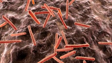 Illustration of tuberculosis bacteria in an organism.